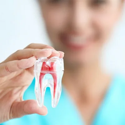 Root Canal Treatment